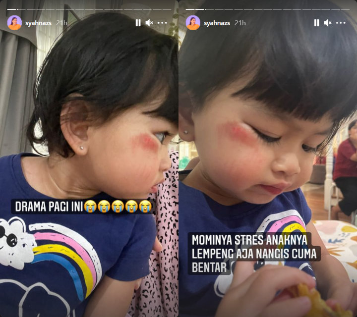 Syahnaz Sadiqah Ceritakan Kondisi Sang Putri Pasca Nyungsep di Aspal