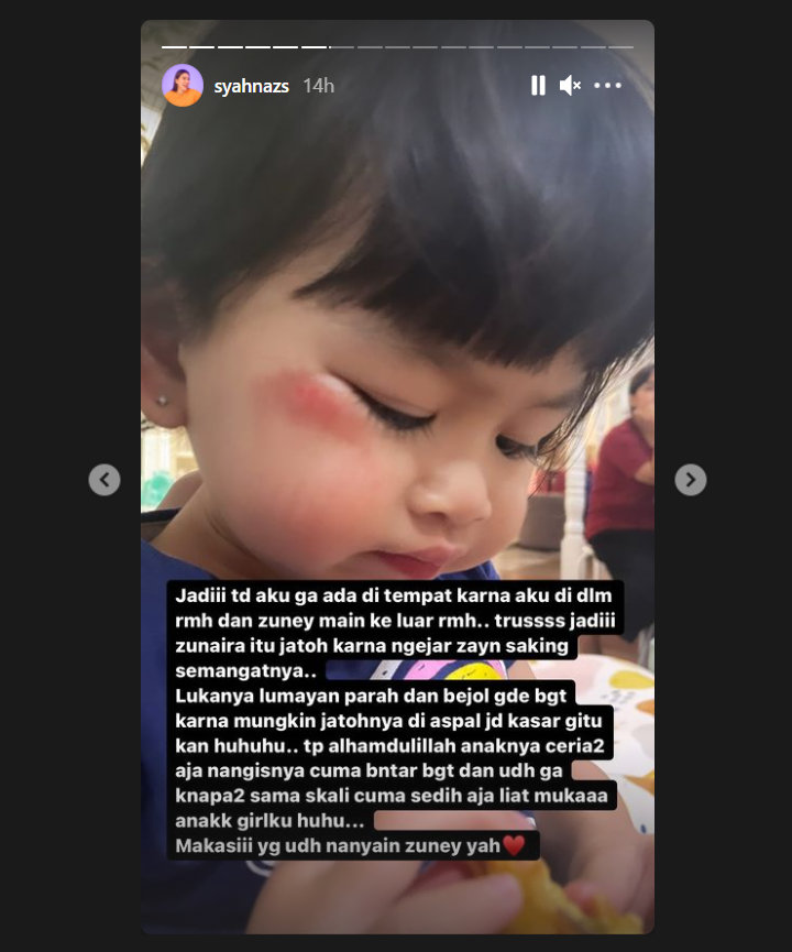 Syahnaz Sadiqah Ceritakan Kondisi Sang Putri Pasca Nyungsep di Aspal