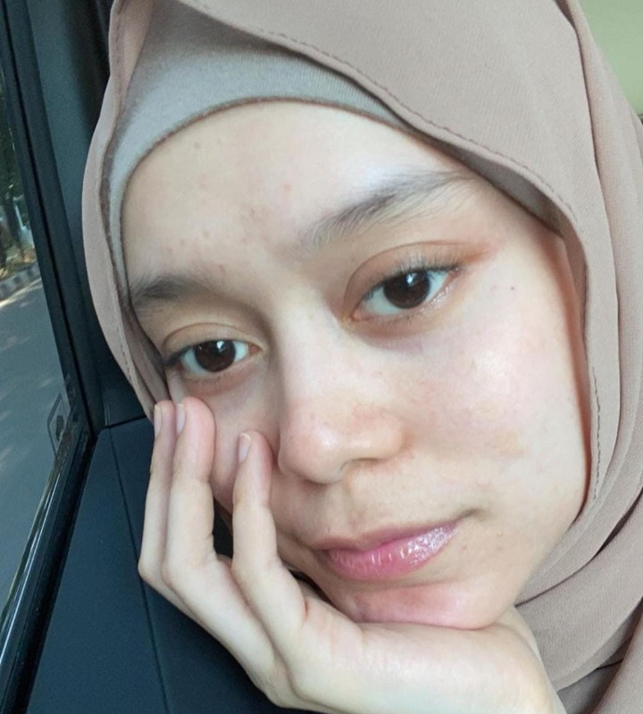 Rajin Melakukan Eksfoliasi untuk Angkat Sel Kulit Mati 