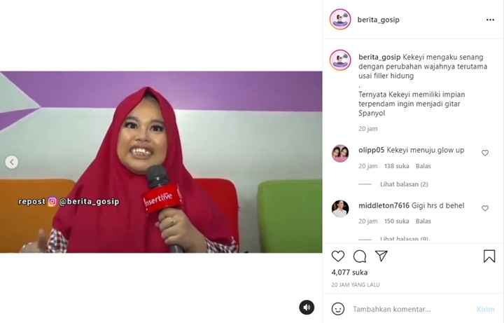 Sudah Diet dan Perawatan, Rahmawati Kekeyi Ungkap Alasan Tak Berani Pasang Behel