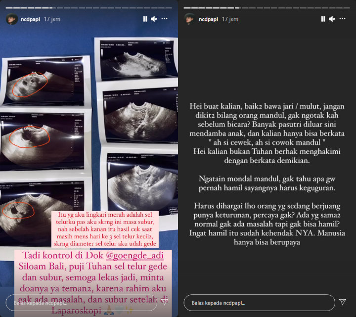 Nora Alexandra Pamer Hasil USG, Ungkap Sempat Hamil Namun Keguguran