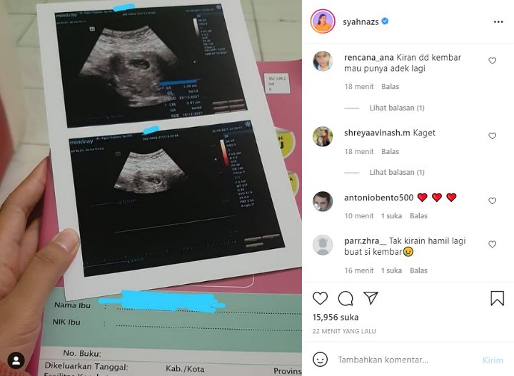 Bikin Heboh, Syahnaz Sadiqah Mendadak Pamer Foto Hasil USG