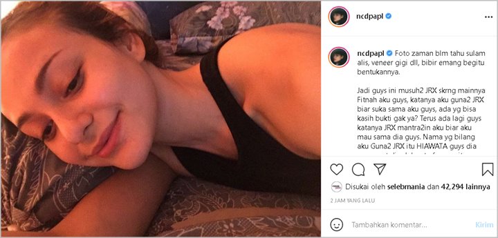 Nora Alexandra Balas Menohok Difitnah Guna-guna Jerinx SID, Foto Lawas Dipuji Mirip Pevita Pearce