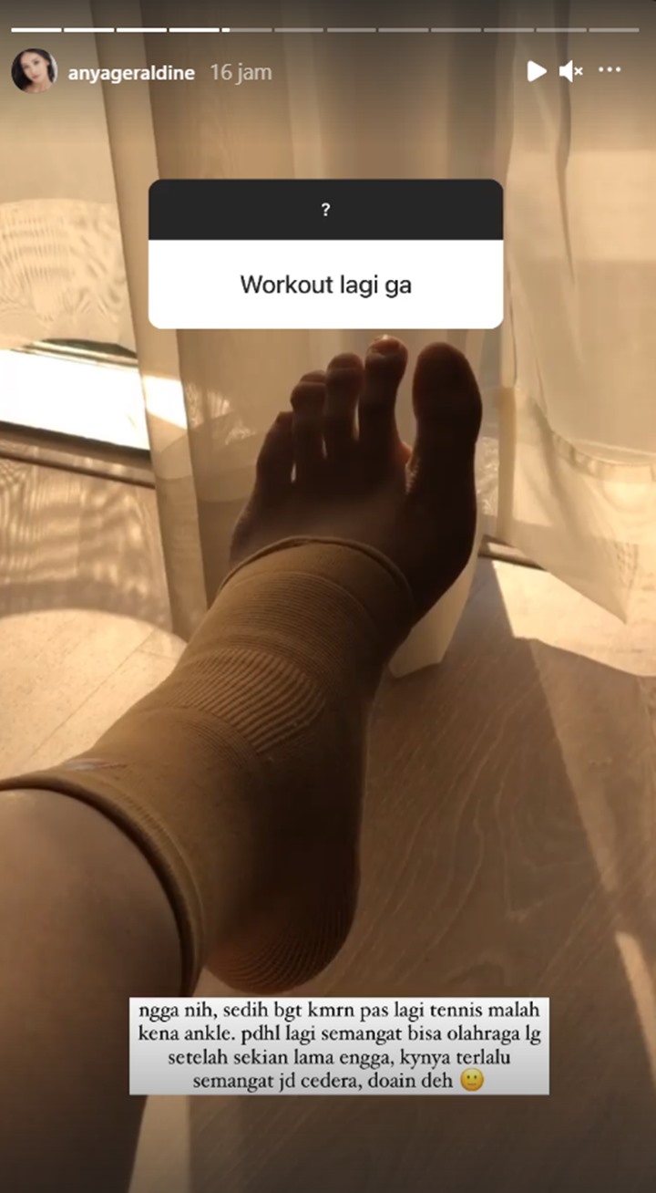 Anya Geraldine Alami Cedera Kaki, Begini Reaksinya Saat Ditertawakan Teman-Teman