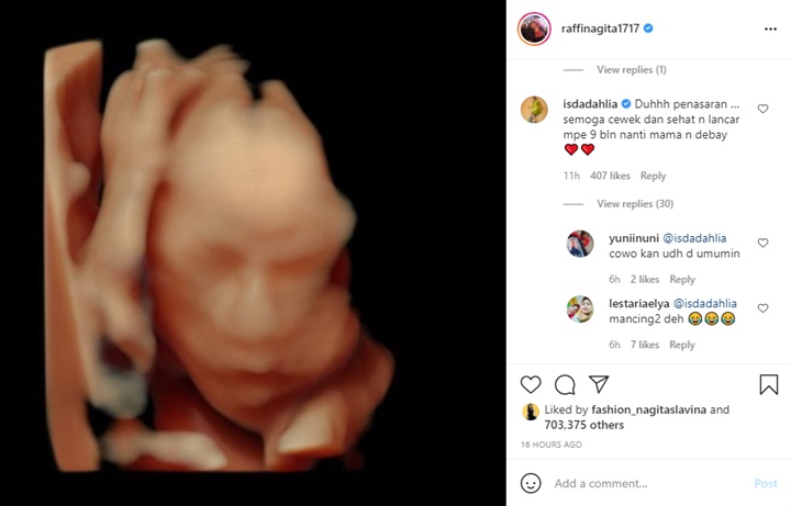 Raffi dan Nagita Ungkap Wajah Calon Bayi, Komentar Iis Dahlia Kok Bikin Geregetan?