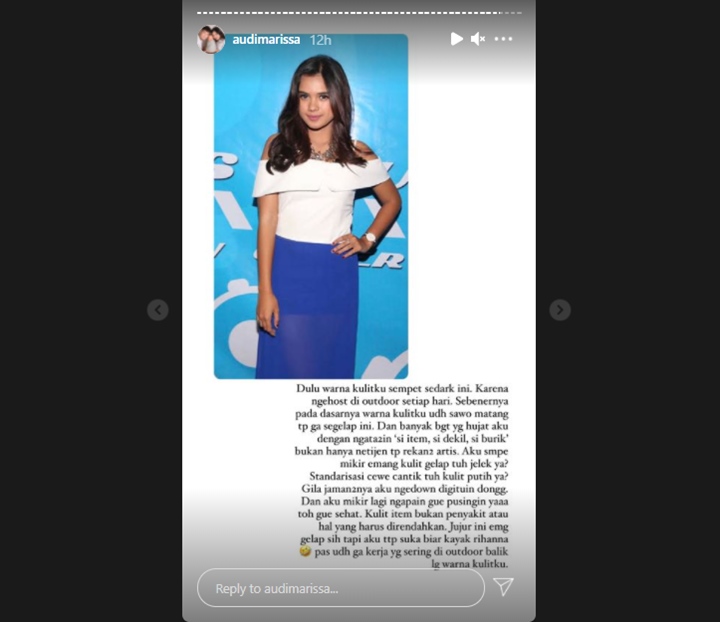 Cerita Audi Marissa Dibilang \'Burik\' oleh Rekan-rekan Artis Karena Kulit Gelap
