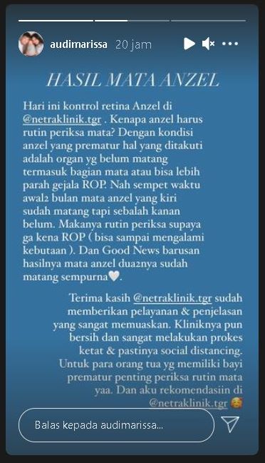 Audi Marissa Jelaskan Alasan Rutin Bawa Baby Anzel Periksa Mata, Bahagia Kini Bawa Kabar Baik