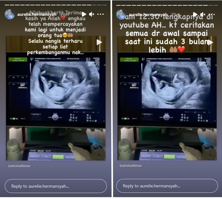 Tiga Bulan Dirahasiakan, Atta Halilintar Akhirnya Umumkan Kabar Kehamilan Aurel Hermansyah