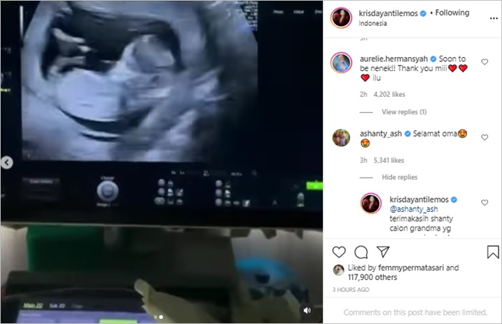 KD