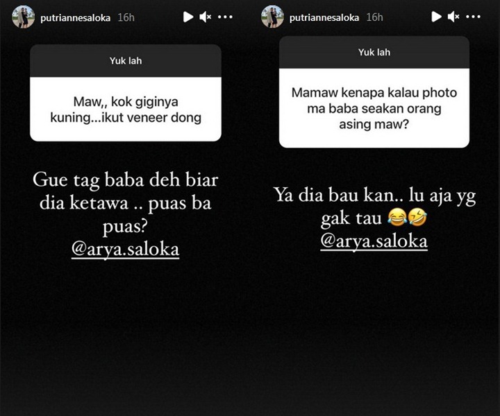Putri Anne Disindir Punya Gigi Kuning Hingga Tak Pernah Mesra Saat Foto Bareng Suami, Begini Katanya