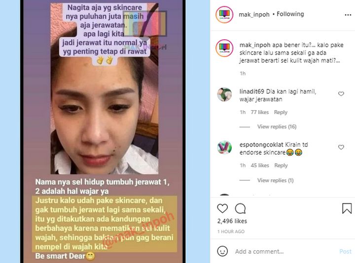 Jerawat Nagita Slavina Jadi Bahan Debat