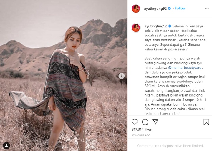 Ayu Ting Ting Ungkap Uneg-uneg yang Selama Ini Dipendam, Wajah Sendu Curi Perhatian