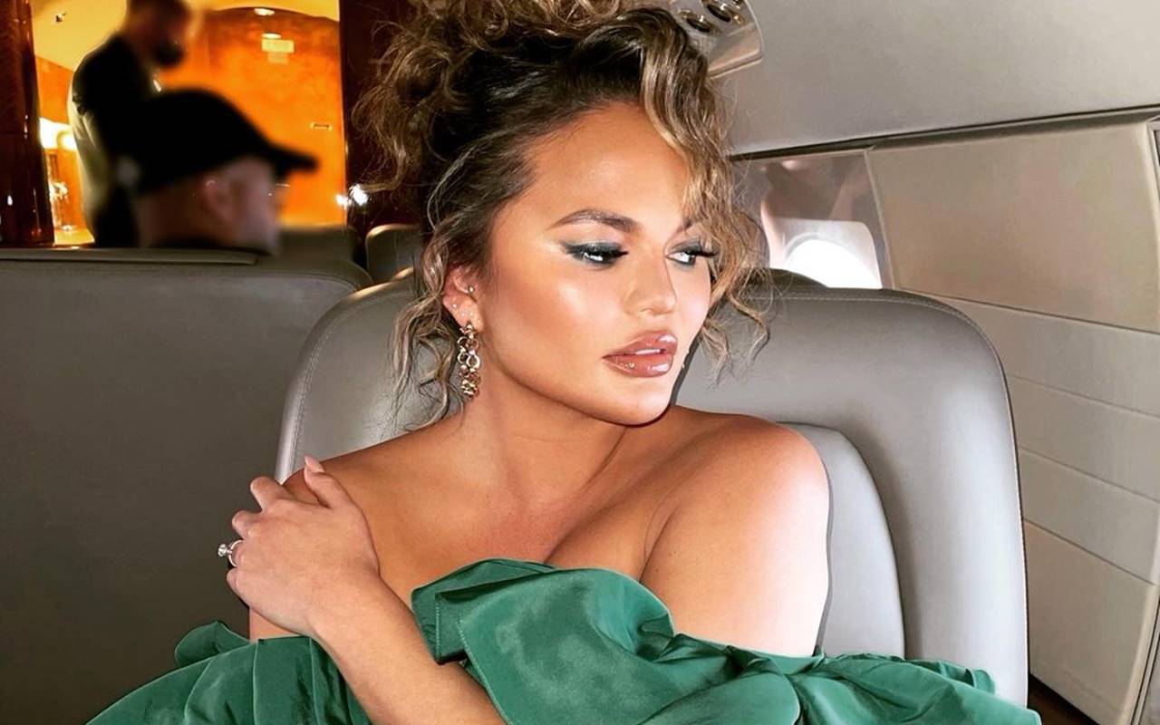 Chrissy Teigen Akui Jalani Bedah Wajah Untuk Hilangkan Lemak Di Pipi, Tuai Respons Negatif?