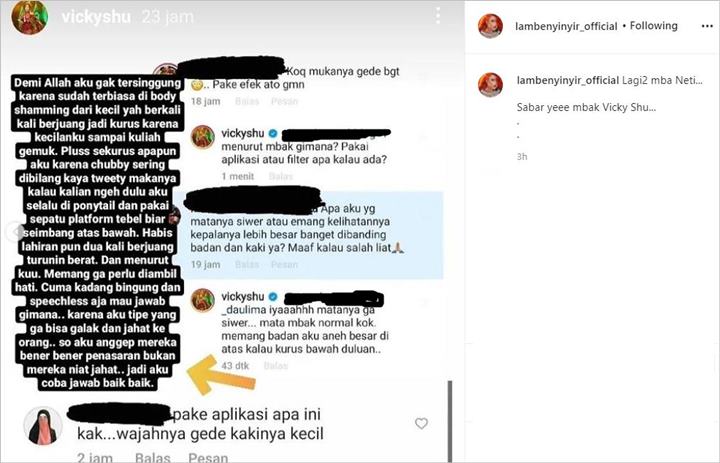Vicky Shu Jawab Kalem Saat Kepala Disebut Terlihat Besar: Aku Anggap Penasaran Bukan Niat Jahat