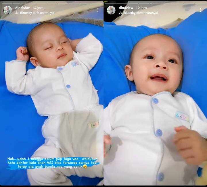 Dinda Hauw Panik Sang Putra Tak BAB 1 Minggu, Begini Kata Dokter