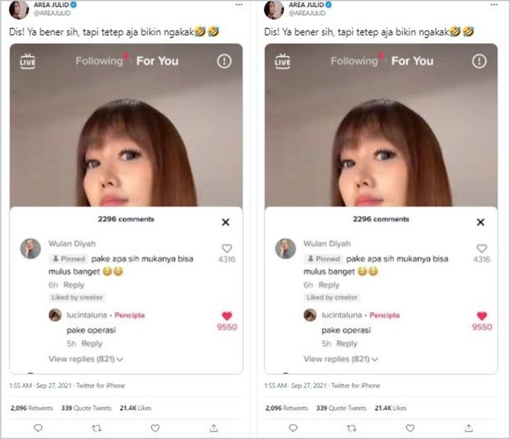 Jawaban Tak Biasa Lucinta Luna Bongkar Rahasia Wajah Mulus, Kejujuran Dipuji Habis