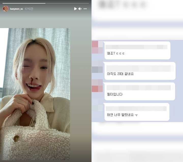 Foto Memar dan Mimisan Tae Yeon Girls\' Generation Kejutkan Fans