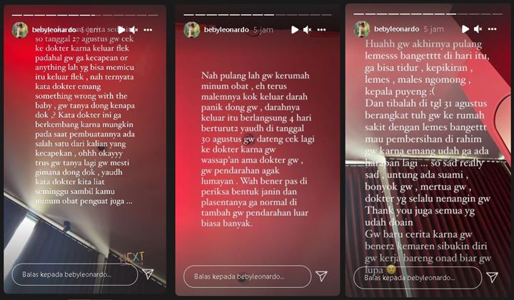 Keguguran Calon Anak Kedua, Istri Onadio Leonardo Ungkap Alami Pendarahan 4 Hari Berturut-turut