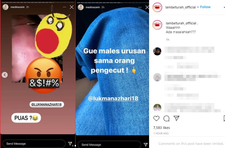 Medina Zein Sebut Suami Pengecut hingga Tunjukkan Lebam di Wajah
