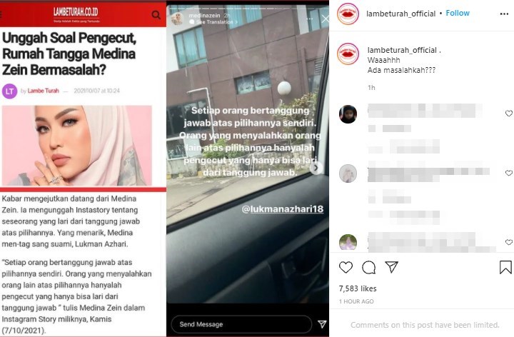 Medina Zein Sebut Suami Pengecut hingga Tunjukkan Lebam di Wajah