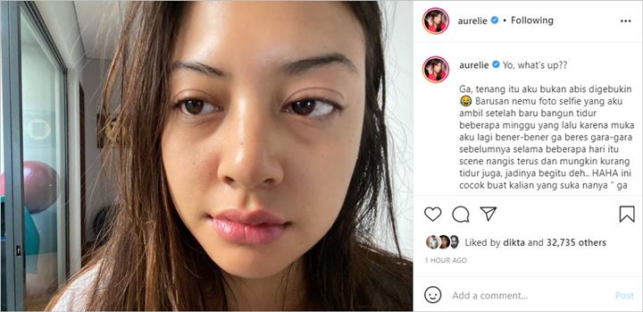 Aurelie Moeremans Minta Fans Tenang Usai Bagikan Foto dengan Mata Sembab, Gercep Beber Faktanya