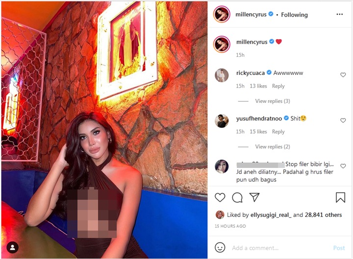 Millendaru Pajang Foto Seksi, Bentuk Bibir Justru Jadi Sorotan