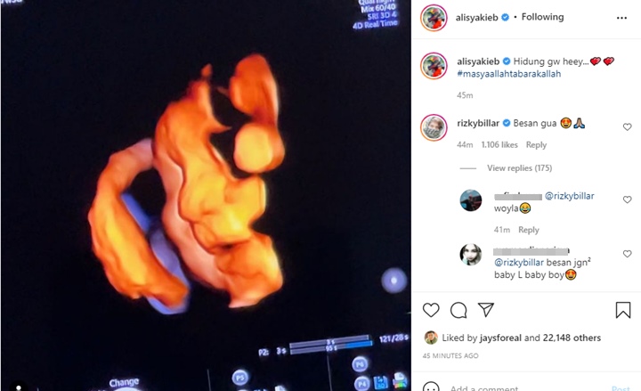 Belum Lahir, Rizky Billar Sudah Panggil Ali Syakieb Besan Gara-gara Unggah Foto USG Anak