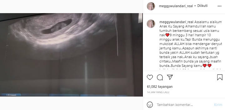 Meggy Wulandari Berharap Mukjizat Saat Kehamilan Usia 10 Minggu, Ramai Diingatkan Penyakit Ain