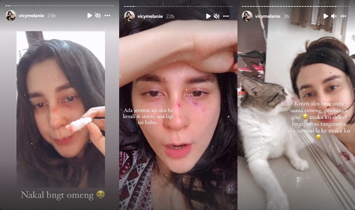 Wajah Cantik Istri Kevin Aprilio Mendadak Berdarah-darah, Begini Kronologinya