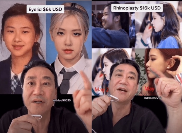 Dokter Bedah Plastik Sebut Rose BLACKPINK Oplas