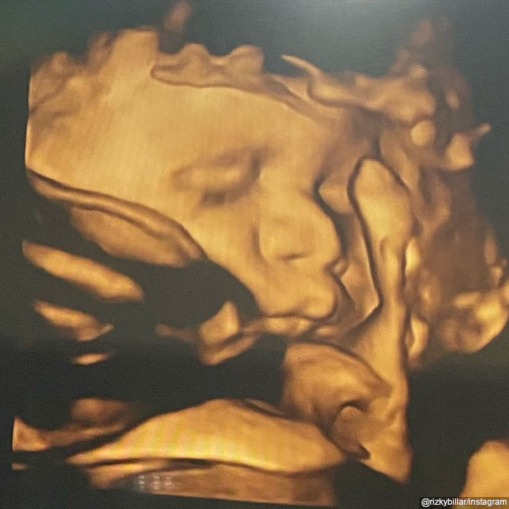 Potret USG bayi rupawan