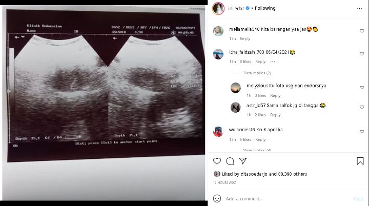 Nikah Oktober, Tanggal Pada Postingan USG Jessica Iskandar Jadi Perbincangan