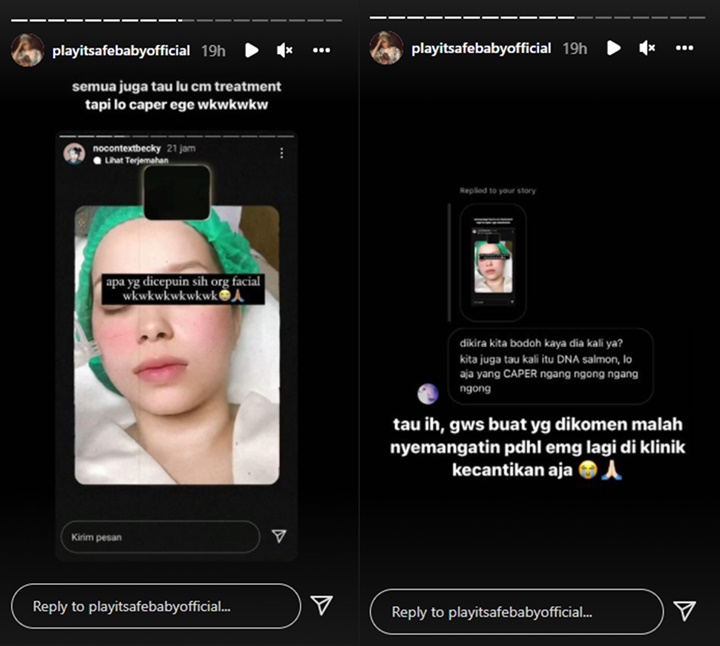 Foto Cantik Hanggini Dipuji, Rebecca Klopper Justru Dinyinyiri Saat Pamer Perawatan Mahal