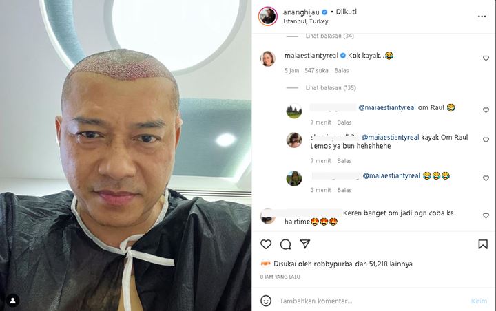 Potong Rambut Botak, Anang Hermansyah Ramai Disebut Mirip Raul Lemos