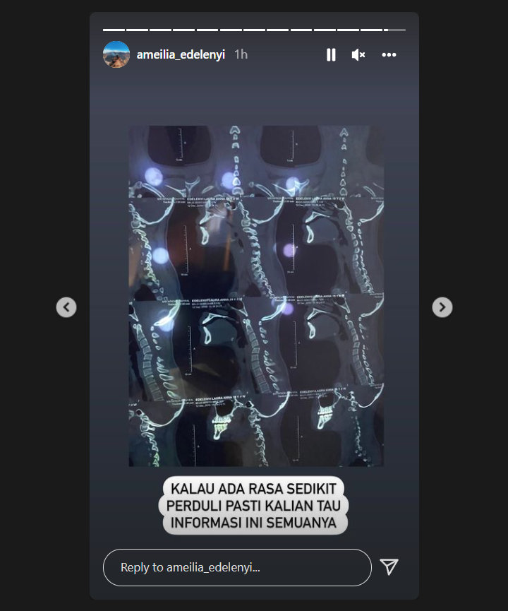 Ibunda Laura Anna Angkat Bicara Usai Ibu Gaga Muhammad Singgung Operasi \'Sia-sia\'