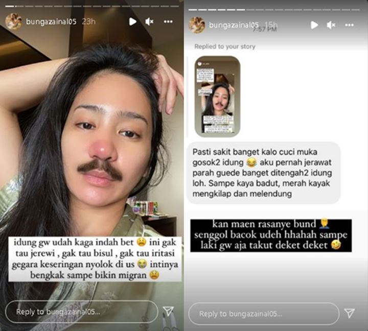 Lagi Karantina, Bunga Zainal Curhat Hidung Bengkak Malah Bikin Ngakak
