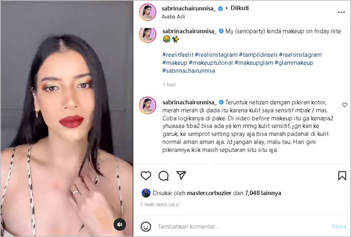 Sabrina Chairunnisa Amuk Komentar Kotor yang Soroti Kulit Memerah di Area Dada: Hari Gini Pikirannya