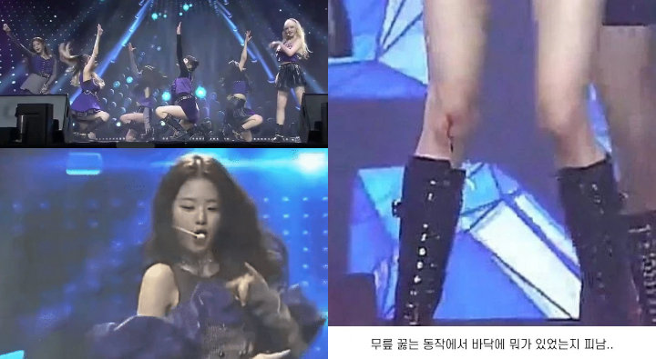 Jang Won Young IVE Lanjutkan Performance dengan Lutut Berdarah, Sikap Profesional Dipuji