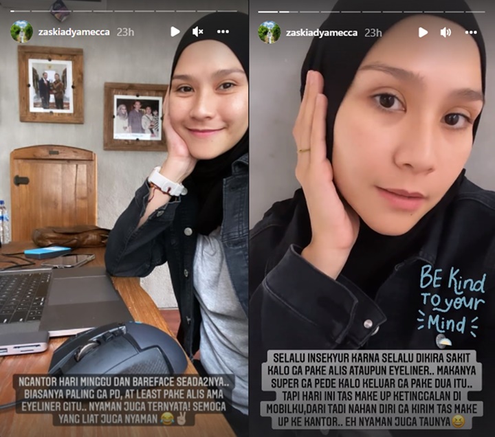 Wajah Pucat No Make Up Buat Zaskia Adya Mecca Insecure, Sering \'Diledek\' Begini