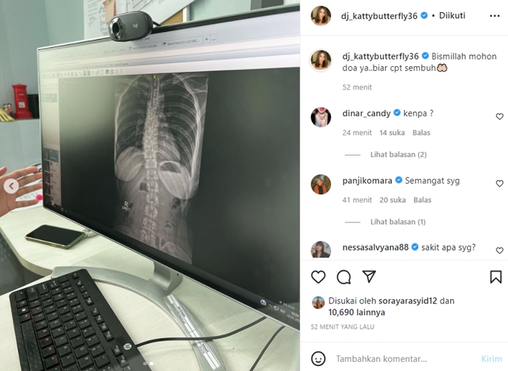 Katty Butterfly Tunjukkan Hasil Rontgen Sambil Minta Doa, Sakit Apa?