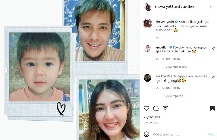 Via Vallen Komentari Hidung \'Calon Anak\', Paras Rupawan Disorot