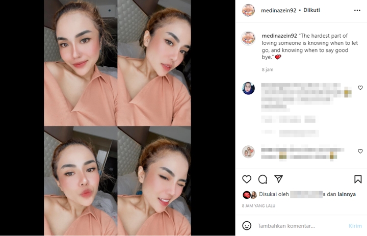 Medina Zein Lepas Hijab Usai Bongkar Perselingkuhan Suami: Inilah Aku Sekarang