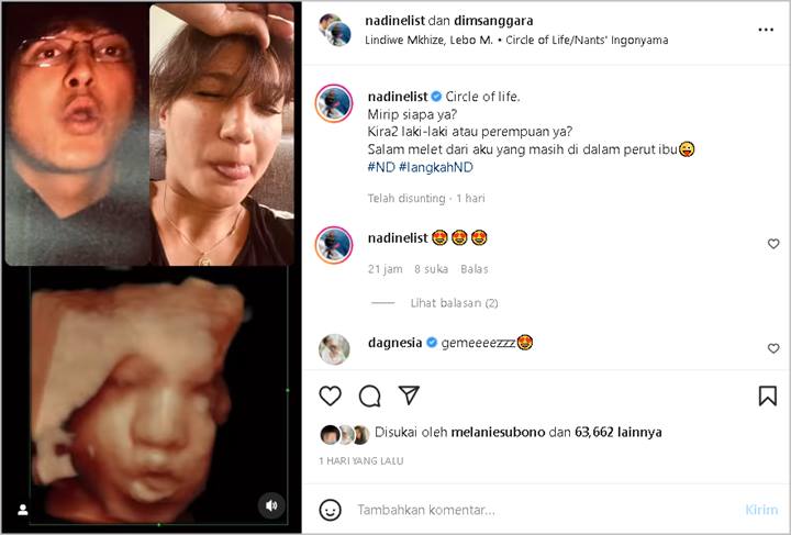 Nadine Chandrawinata Akhirnya Pamer USG, Heboh Bayinya Dipuji Sudah Good Looking