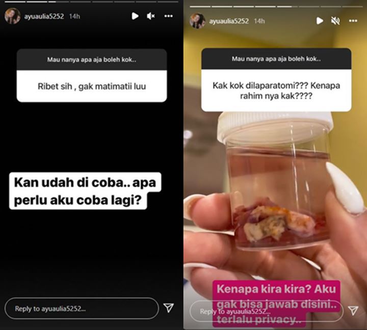 Ayu Aulia Jalani Operasi, Begini Reaksinya Saat Ada Netizen Minta Dirinya Mati