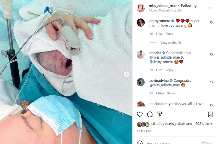 Istri Derby Romero Dibully Soal Operasi Caesar