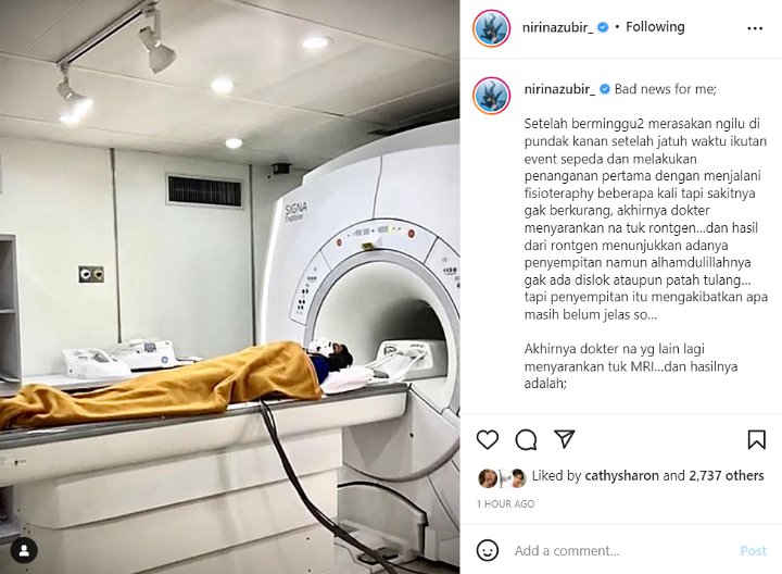 Nirina Zubir Ngenes Dilarang Sepedaan Usai Bahu Cedera, Begini Kondisinya