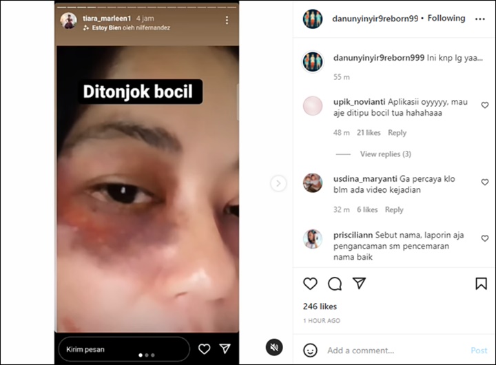 Tak Ada Angin Atau Hujan, Fadly Faisal Mendadak Dituduh Tonjok Tiara Marleen Sampai Memar