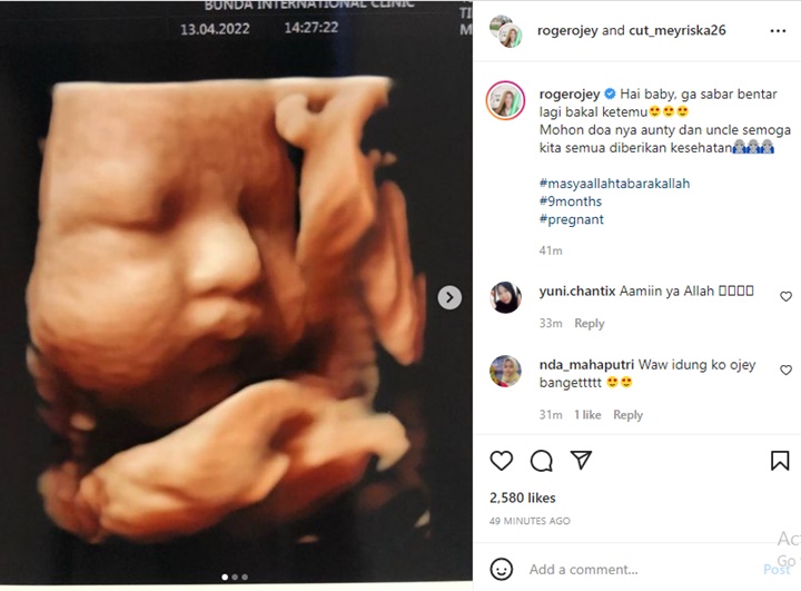 Roger Danuarta Pamer Foto USG Terbaru, Hidung Mancung Plus Pipi Chubby Calon Buah Hati Bikin Salfok