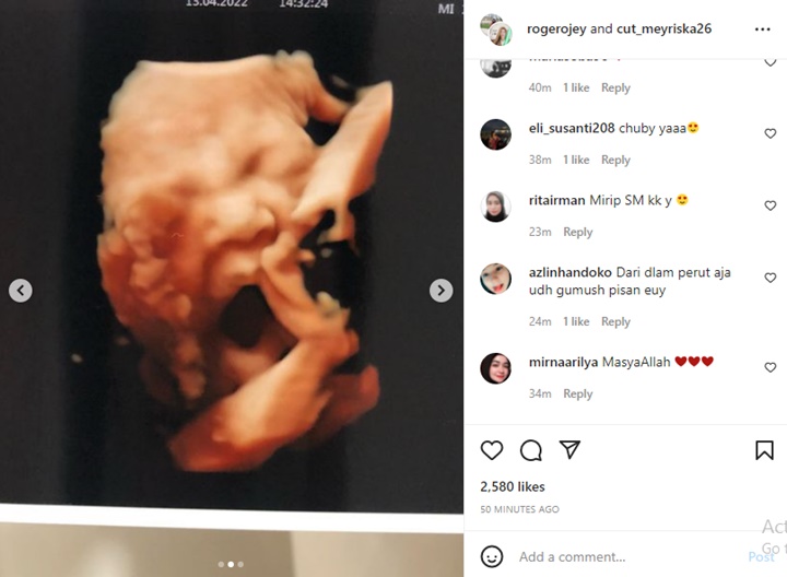 Roger Danuarta Pamer Foto USG Terbaru, Hidung Mancung Plus Pipi Chubby Calon Buah Hati Bikin Salfok