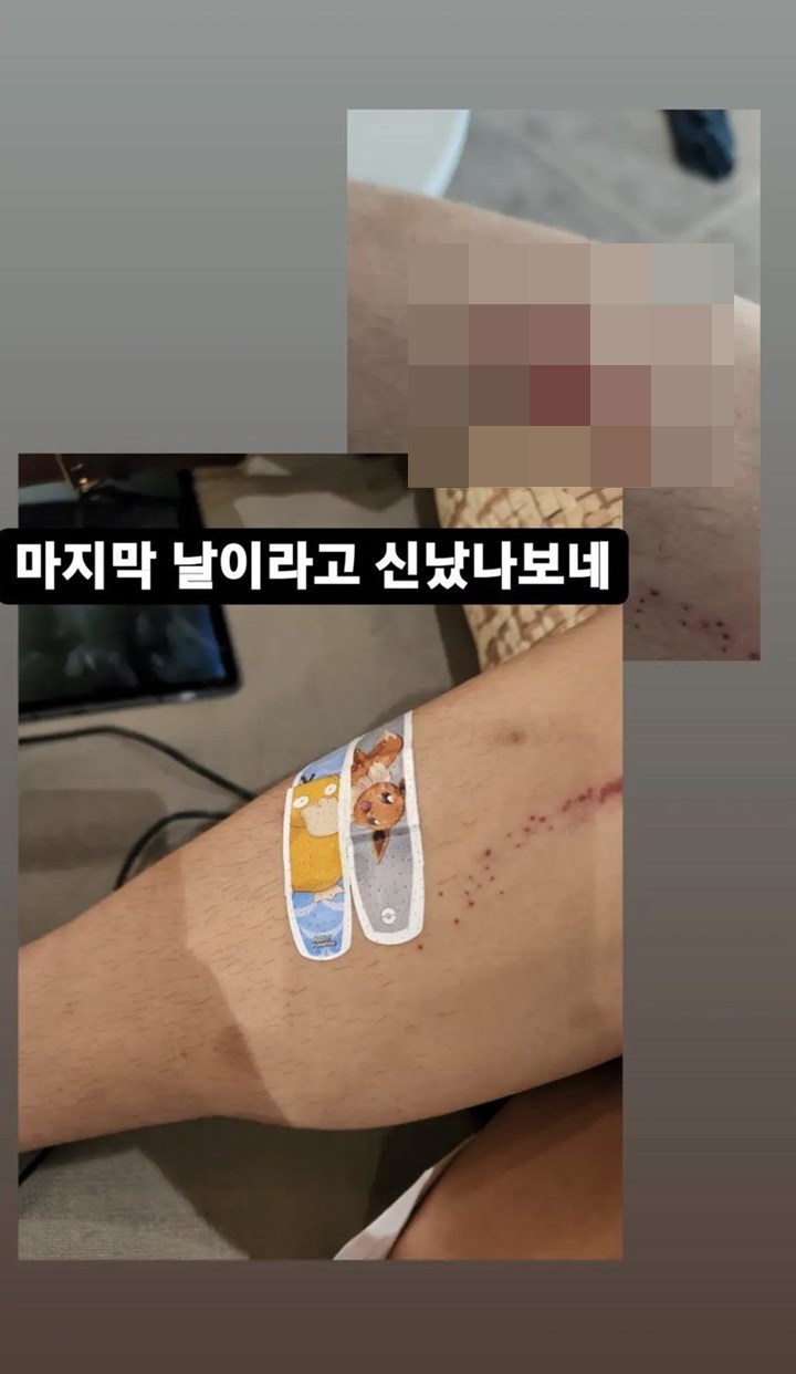 Balik ke Korea, V BTS Posting Foto Mengkhawatirkan Tapi Buru-Buru Dihapus 2